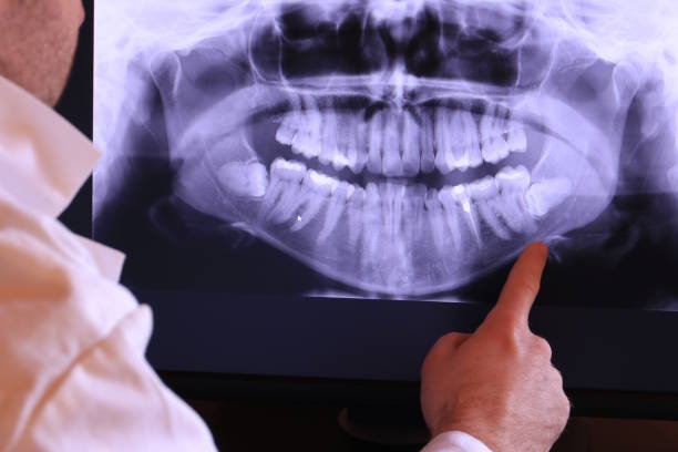Best Emergency Dental Extractions in Fishhook, AK