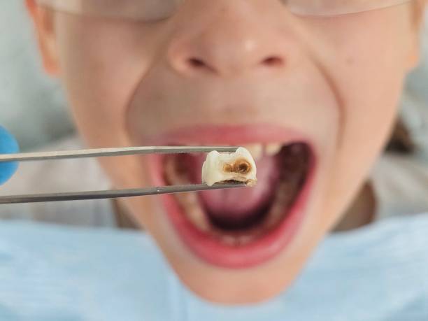 Best Mobile Emergency Dentist in Fishhook, AK