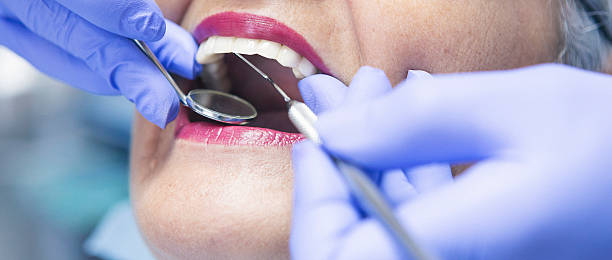 Best Emergency Dentist for Knocked-Out Tooth in Fishhook, AK